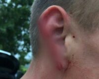 В Новгородской области уроженец Средней Азии откусил у противника кусок уха